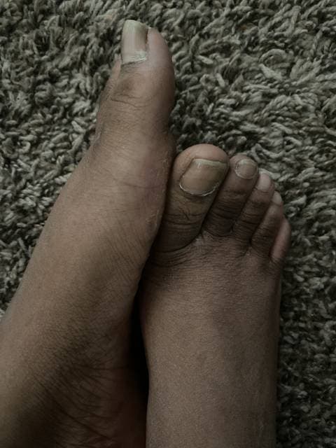 Ugly Feet OnlyFans – free nudes, naked, leaked